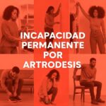 Incapacidad permanente por Artrodesis